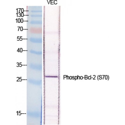 BCL2 / Bcl-2 Antibody - Western blot of Phospho-Bcl-2 (S70) antibody