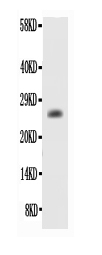 BCL2 / Bcl-2 Antibody - Western blot - Anti-human BCL-2 Antibody