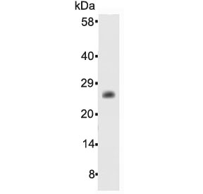 BCL2 / Bcl-2 Antibody - Western blot testing of human recombinant protein with Bcl-2 antibody at 0.5ug/ml.