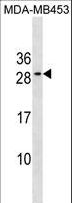 BCL2 / Bcl-2 Antibody - BCL2 Antibody western blot of MDA-MB453 cell line lysates (35 ug/lane). The BCL2 antibody detected the BCL2 protein (arrow).