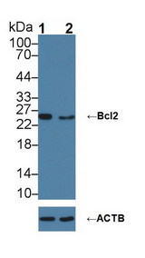 BCL2 / Bcl-2 Antibody - Knockout Varification: Lane 1: Wild-type HL-60 cell lysate; Lane 2: Bcl2 knockout HL-60 cell lysate; Predicted MW: 22,26kDa ; Observed MW: 26kDa; Primary Ab: 5µg/ml Rabbit Anti-Mouse Bcl2 Antibody; Second Ab: 0.2µg/mL HRP-Linked Caprine Anti-Rabbit IgG Polyclonal Antibody;