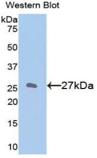 BCL2 / Bcl-2 Antibody - Western blot of recombinant BCL2 / Bcl-2.  This image was taken for the unconjugated form of this product. Other forms have not been tested.