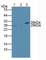 BCL2 / Bcl-2 Antibody - Western Blot; Sample: Lane1: Human Jurkat Cells; Lane2: Human U937 Cells; Lane3: Mouse Pancreas Tissue.