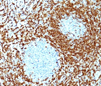 BCL2 / Bcl-2 Antibody - Bcl2 antibody immunohistochemistry.  This image was taken for the unmodified form of this product. Other forms have not been tested.