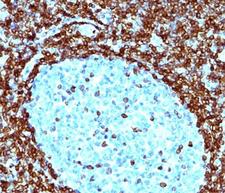 BCL2 / Bcl-2 Antibody - Bcl-2 antibody immunohistochemistry.  This image was taken for the unmodified form of this product. Other forms have not been tested.