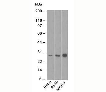 BCL2 / Bcl-2 Antibody - Bcl-2 antibody western blot.  This image was taken for the unmodified form of this product. Other forms have not been tested.