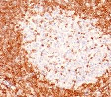 BCL2 / Bcl-2 Antibody - Bcl-2 antibody immunohistochemistry.  This image was taken for the unmodified form of this product. Other forms have not been tested.