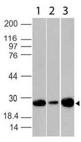 BCL2 / Bcl-2 Antibody - Fig-1: Western blot analysis of Bcl2. Anti-Bcl2(Clone: BC1) was used at 2 µg/ml on 293, MCF7 and Jurkat lysates.