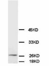 BCL2 / Bcl-2 Antibody -  This image was taken for the unconjugated form of this product. Other forms have not been tested.