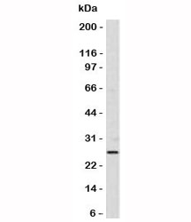 BCL2 / Bcl-2 Antibody - Western blot of Bcl-2 in human skin using anti-Bcl-2 antibody (SPM530).  This image was taken for the unmodified form of this product. Other forms have not been tested.