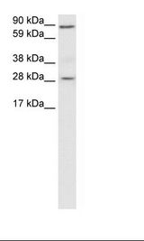 BCL2 / Bcl-2 Antibody - Placenta Lysate.  This image was taken for the unconjugated form of this product. Other forms have not been tested.