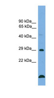 BCL2 / Bcl-2 Antibody - BCL2 / Bcl-2 antibody Western blot of Jurkat lysate. This image was taken for the unconjugated form of this product. Other forms have not been tested.