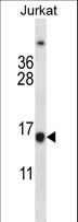 BCL2 / Bcl-2 Antibody - BCL2 Antibody western blot of Jurkat cell line lysates (35 ug/lane). The BCL2 antibody detected the BCL2 protein (arrow).