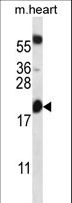 BCL2 / Bcl-2 Antibody - BCL2 Antibody western blot of mouse heart tissue lysates (35 ug/lane). The BCL2 antibody detected the BCL2 protein (arrow).