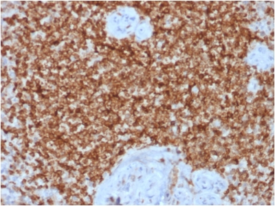 BCL2 / Bcl-2 Antibody - Formalin-fixed, paraffin-embedded human Spleen stained with Bcl-2 Rabbit Recombinant Monoclonal Antibody (BCL2/1878R).