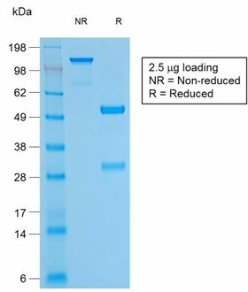 BCL2 / Bcl-2 Antibody - SDS-PAGE Analysis Purified Bcl-2 Rabbit Recombinant Monoclonal Antibody (BCL2/1878R). Confirmation of Purity and Integrity of Antibody.