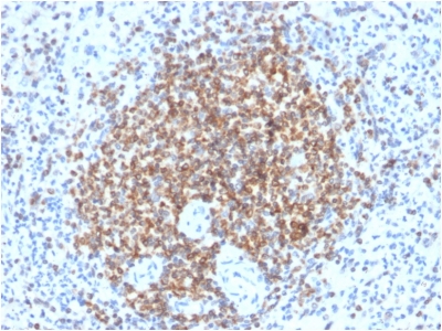 BCL2 / Bcl-2 Antibody - Formalin-fixed, paraffin-embedded human spleen stained with Bcl-2 Rabbit Recombinant Monoclonal Antibody (BCL2/2210R).