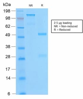 BCL2 / Bcl-2 Antibody - SDS-PAGE Analysis of Purified Bcl-2 Rabbit Recombinant Monoclonal Antibody (BCL2/2210R). Confirmation of Purity and Integrity of Antibody.