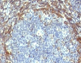 BCL2 / Bcl-2 Antibody - Formalin-fixed, paraffin-embedded human tonsil stained with Bcl2 antibody (BCL2/782).  This image was taken for the unmodified form of this product. Other forms have not been tested.