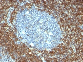 BCL2 / Bcl-2 Antibody - Formalin-fixed, paraffin-embedded human tonsil stained with Bcl-2 antibody (BCL2/796).  This image was taken for the unmodified form of this product. Other forms have not been tested.