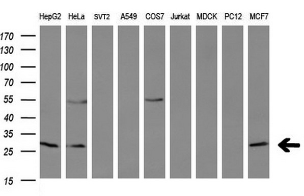 BCL2 / Bcl-2 Antibody - Western blot analysis of extracts. (35ug) from 9 different cell lines by using anti-BCL2 monoclonal antibody at 1:200. (HepG2: human; HeLa: human; SVT2: mouse; A549: human; COS7: monkey; Jurkat: human; MDCK: canine;rat; MCF7: human).