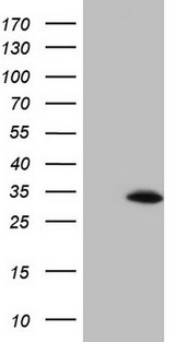 BCL2 / Bcl-2 Antibody - HEK293T cells were transfected with the pCMV6-ENTRY control (Left lane) or pCMV6-ENTRY BCL2 (Right lane) cDNA for 48 hrs and lysed. Equivalent amounts of cell lysates (5 ug per lane) were separated by SDS-PAGE and immunoblotted with anti-BCL2.
