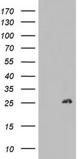 BCL2 / Bcl-2 Antibody - HEK293T cells were transfected with the pCMV6-ENTRY control (Left lane) or pCMV6-ENTRY BCL2 (Right lane) cDNA for 48 hrs and lysed. Equivalent amounts of cell lysates (5 ug per lane) were separated by SDS-PAGE and immunoblotted with anti-BCL2.