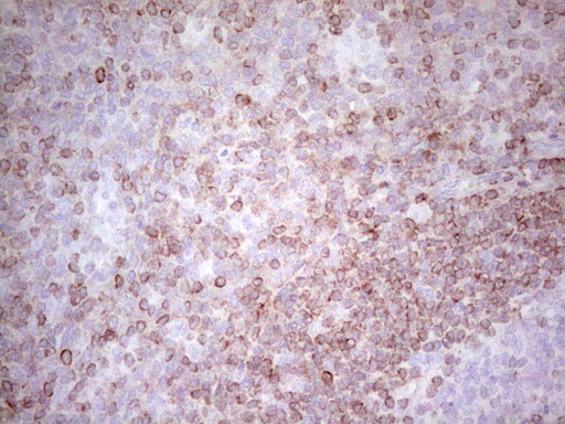 BCL2 / Bcl-2 Antibody - Immunohistochemical staining of paraffin-embedded Human tonsil within the normal limits using anti-BCL2 mouse monoclonal antibody. (Heat-induced epitope retrieval by 1 mM EDTA in 10mM Tris, pH8.5, 120C for 3min,