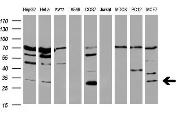 BCL2 / Bcl-2 Antibody - Western blot of extracts (35ug) from 9 different cell lines by using anti-BCL2 monoclonal antibody at 1:200 (HepG2: human; HeLa: human; SVT2: mouse; A549: human; COS7: monkey; Jurkat: human; MDCK: canine; PC12: rat; MCF7: human).