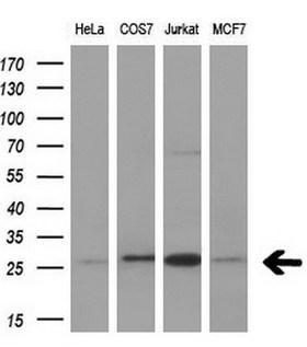BCL2 / Bcl-2 Antibody - Western blot analysis of extracts. (10ug) from 4 different cell lines by using anti-BCL2 monoclonal antibody. (1:200)