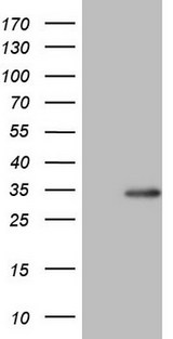 BCL2 / Bcl-2 Antibody - HEK293T cells were transfected with the pCMV6-ENTRY control. (Left lane) or pCMV6-ENTRY BCL2. (Right lane) cDNA for 48 hrs and lysed. Equivalent amounts of cell lysates. (5 ug per lane) were separated by SDS-PAGE and immunoblotted with anti-BCL2.