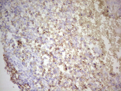 BCL2 / Bcl-2 Antibody - Immunohistochemical staining of paraffin-embedded Human tonsil within the normal limits using anti-BCL2 mouse monoclonal antibody. (Heat-induced epitope retrieval by 1 mM EDTA in 10mM Tris, pH8.5, 120C for 3min,