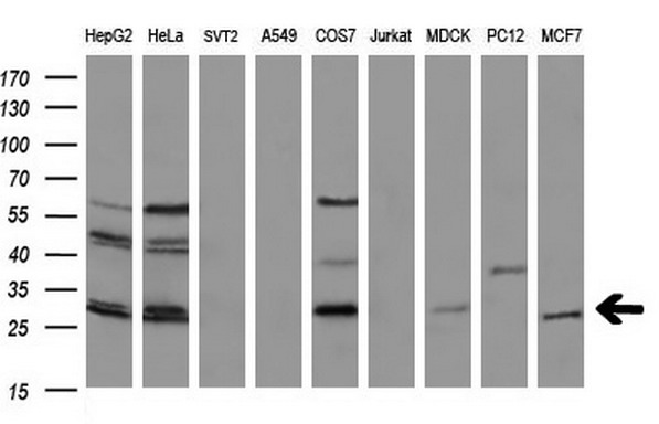BCL2 / Bcl-2 Antibody - Western blot analysis of extracts. (35ug) from 9 different cell lines by using anti-BCL2 monoclonal antibody at 1:200. (HepG2: human; HeLa: human; SVT2: mouse; A549: human; COS7: monkey; Jurkat: human; MDCK: canine;rat; MCF7: human).