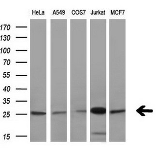 BCL2 / Bcl-2 Antibody - Western blot analysis of extracts. (10ug) from 5 different cell lines by using anti-BCL2 monoclonal antibody. (1:200)