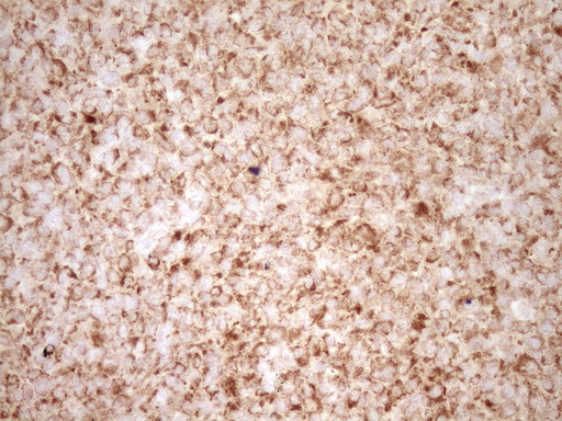 BCL2 / Bcl-2 Antibody - IHC of paraffin-embedded Human lymph node tissue using anti-BCL2 mouse monoclonal antibody. (Heat-induced epitope retrieval by 1 mM EDTA in 10mM Tris, pH8.5, 120°C for 3min).