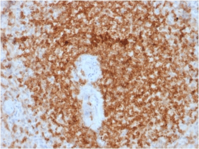 BCL2 / Bcl-2 Antibody - Formalin-fixed, paraffin-embedded human Spleen stained with Bcl-2 Mouse Recombinant Monoclonal Antibody (rBCL2/796).