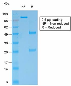 BCL2 / Bcl-2 Antibody - SDS-PAGE Analysis Purified Bcl-2 Mouse Recombinant Monoclonal Antibody (rBCL2/796). Confirmation of Purity and Integrity of Antibody.