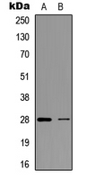 BCL2 / Bcl-2 Antibody - Western blot analysis of BCL2 expression in HeLa (A); A2780 (B) whole cell lysates.