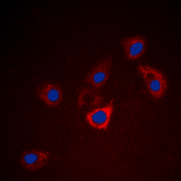 BCL2 / Bcl-2 Antibody - Immunofluorescent analysis of BCL2 staining in HeLa cells. Formalin-fixed cells were permeabilized with 0.1% Triton X-100 in TBS for 5-10 minutes and blocked with 3% BSA-PBS for 30 minutes at room temperature. Cells were probed with the primary antibody in 3% BSA-PBS and incubated overnight at 4 C in a humidified chamber. Cells were washed with PBST and incubated with a DyLight 594-conjugated secondary antibody (red) in PBS at room temperature in the dark. DAPI was used to stain the cell nuclei (blue).