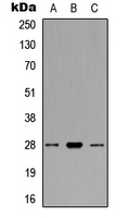 BCL2 / Bcl-2 Antibody - Western blot analysis of BCL2 expression in MCF7 (A); Raw264.7 (B); NIH3T3 (C) whole cell lysates.