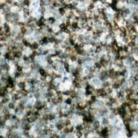 BCL2 / Bcl-2 Antibody - Immunohistochemical analysis of BCL2 staining in human lymph node formalin fixed paraffin embedded tissue section. The section was pre-treated using heat mediated antigen retrieval with sodium citrate buffer (pH 6.0). The section was then incubated with the antibody at room temperature and detected using an HRP-conjugated compact polymer system. DAB was used as the chromogen. The section was then counterstained with hematoxylin and mounted with DPX.