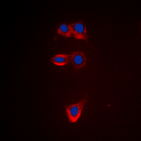 BCL2 / Bcl-2 Antibody - Immunofluorescent analysis of BCL2 staining in HeLa cells. Formalin-fixed cells were permeabilized with 0.1% Triton X-100 in TBS for 5-10 minutes and blocked with 3% BSA-PBS for 30 minutes at room temperature. Cells were probed with the primary antibody in 3% BSA-PBS and incubated overnight at 4 deg C in a humidified chamber. Cells were washed with PBST and incubated with a DyLight 594-conjugated secondary antibody (red) in PBS at room temperature in the dark. DAPI was used to stain the cell nuclei (blue).