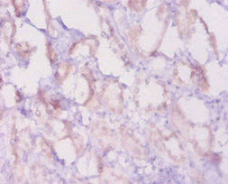 BCL2 / Bcl-2 Antibody - Immunohistochemistry of paraffin-embedded human kidney tissue using Bcl2 Antibody at dilution of 1:20