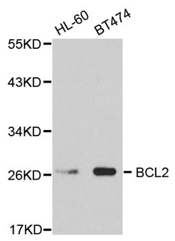 BCL2 / Bcl-2 Antibody - Western blot analysis of extracts of various cell lines.