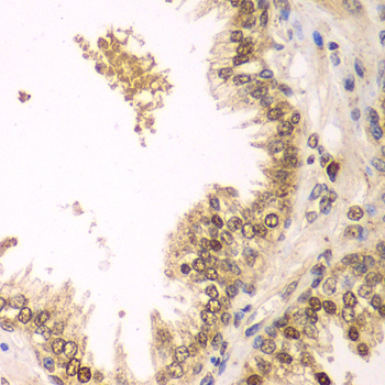 BCL2 / Bcl-2 Antibody - Immunohistochemistry of paraffin-embedded human prostate.