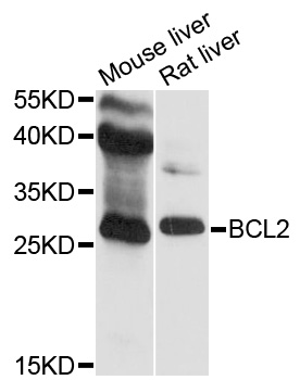 BCL2 / Bcl-2 Antibody - Western blot analysis of extracts of various cell lines, using BCL2 antibody at 1:500 dilution. The secondary antibody used was an HRP Goat Anti-Rabbit IgG (H+L) at 1:10000 dilution. Lysates were loaded 25ug per lane and 3% nonfat dry milk in TBST was used for blocking. An ECL Kit was used for detection and the exposure time was 90s.