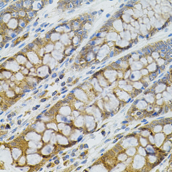 BCL2 / Bcl-2 Antibody - Immunohistochemistry of paraffin-embedded human colon tissue.