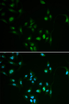 BCL2 / Bcl-2 Antibody - Immunofluorescence analysis of MCF7 cells.