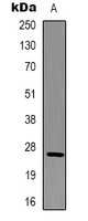 BCL2 / Bcl-2 Antibody - Western blot analysis of BCL2 expression in HeLa (A) whole cell lysates.