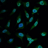 BCL2 / Bcl-2 Antibody - Immunofluorescent analysis of BCL2 staining in HeLa cells. Formalin-fixed cells were permeabilized with 0.1% Triton X-100 in TBS for 5-10 minutes and blocked with 3% BSA-PBS for 30 minutes at room temperature. Cells were probed with the primary antibody in 3% BSA-PBS and incubated overnight at 4 deg C in a humidified chamber. Cells were washed with PBST and incubated with a FITC-conjugated secondary antibody (green) in PBS at room temperature in the dark. DAPI was used to stain the cell nuclei (blue).